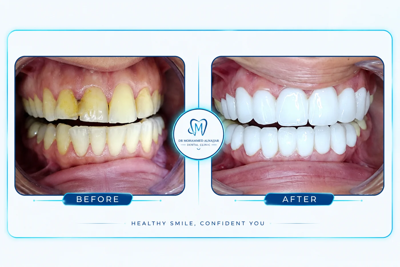 Before and after cases from the clinic 1