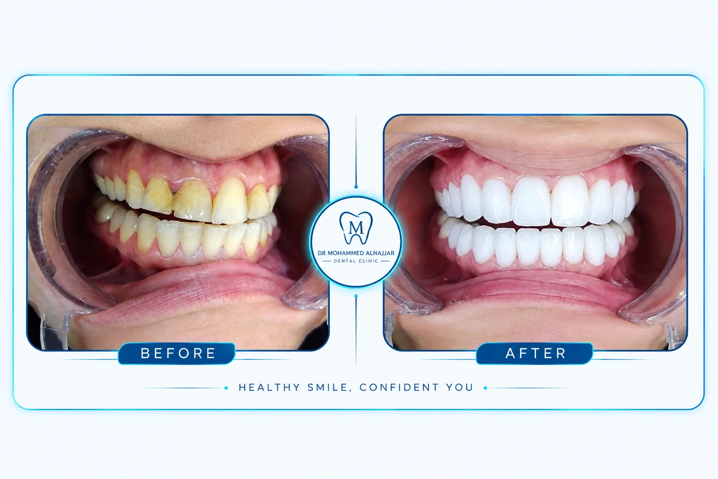 Before and after cases from the clinic 2