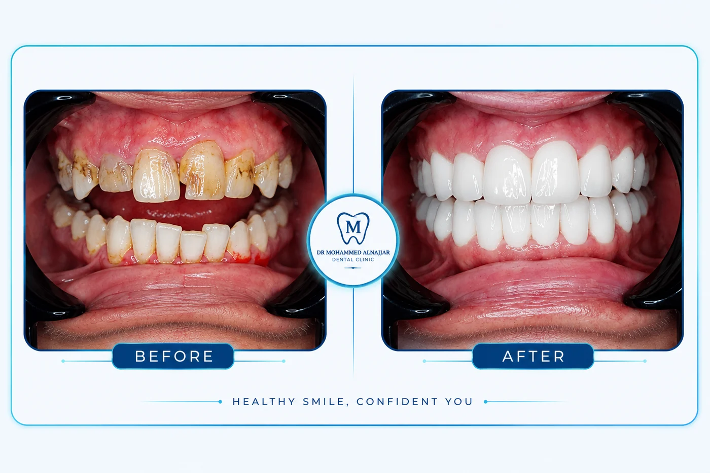 Before and after cases from the clinic 3